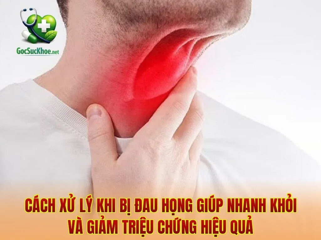 Cách xử lý khi bị đau họng giúp nhanh khỏi và giảm triệu chứng hiệu quả