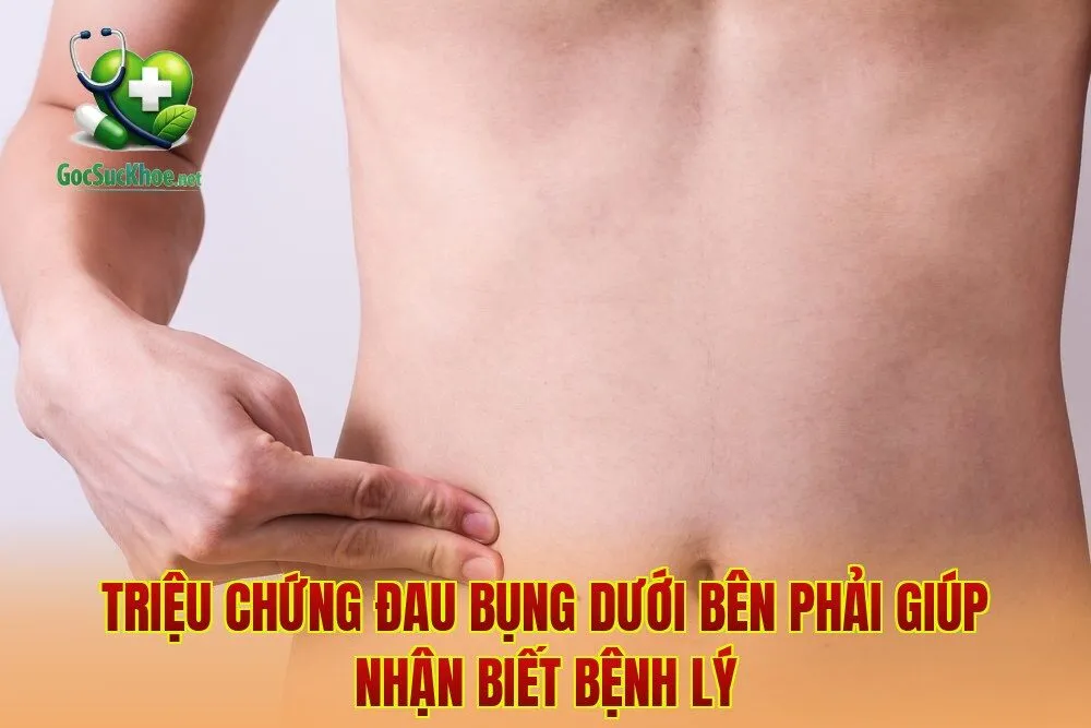 Triệu chứng đau bụng dưới bên phải giúp nhận biết bệnh lý
